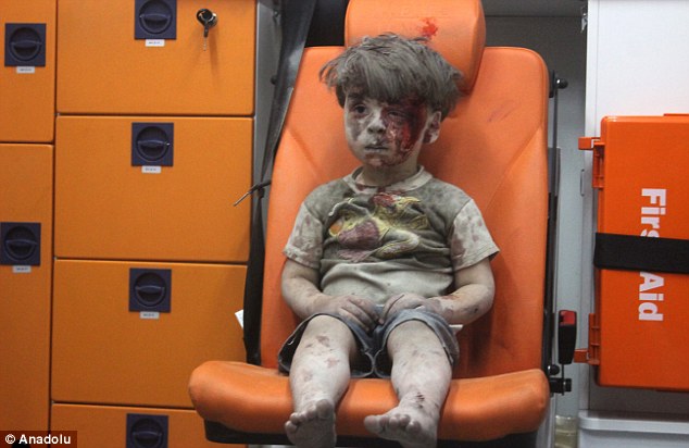 Omran-Daqneesh-2