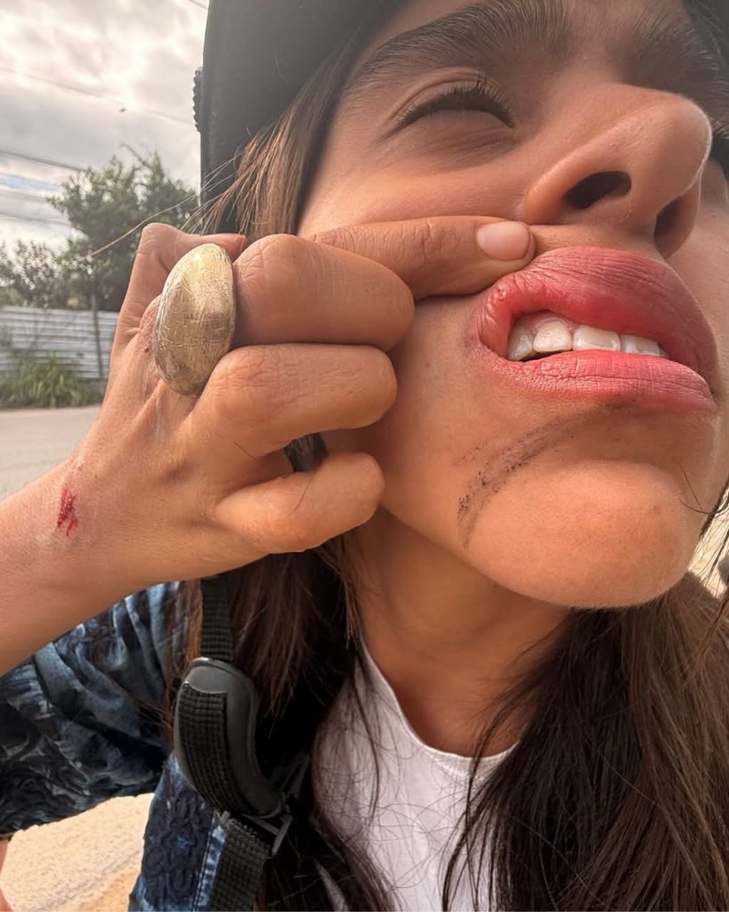 Cable colgante provoca accidente y refuerzan vigilancia en Tulum