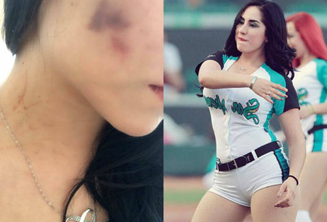 porrista-denuncia-a-novio-violencia