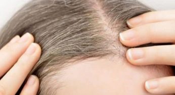 ¿Por qué salen canas a temprana edad?