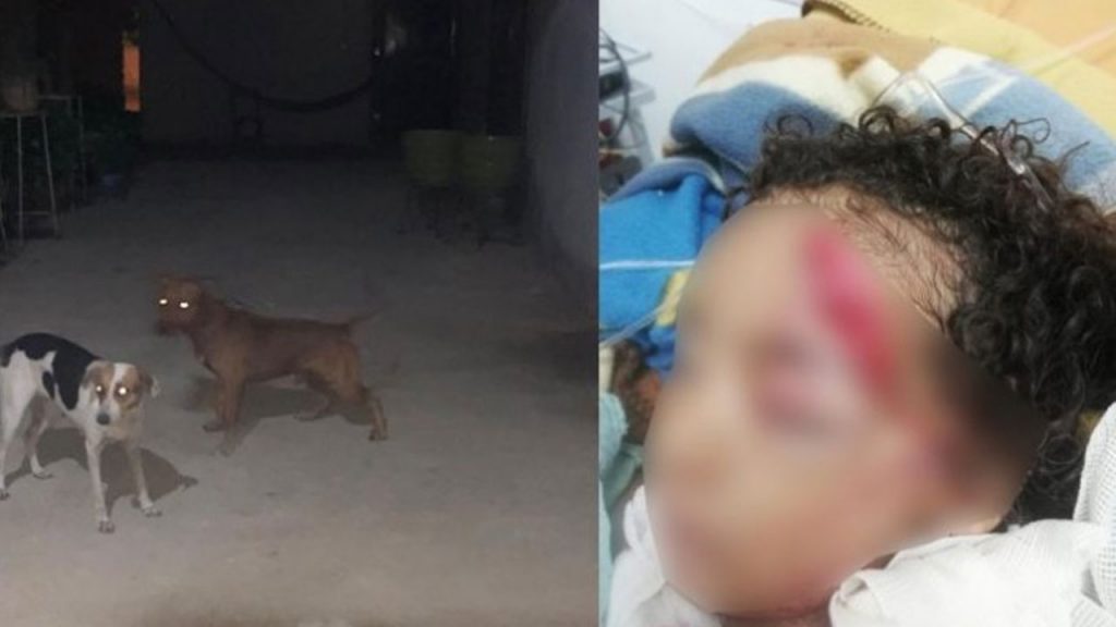 Niña es atacada por perros ¡de su hermana!