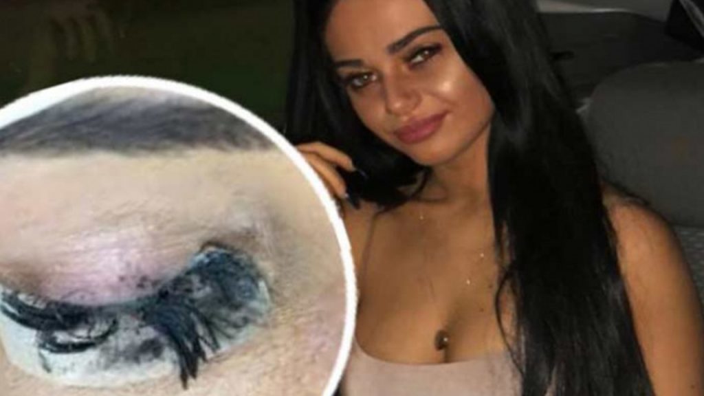Fue por extensiones de pestañas y terminó con los ojos pegados