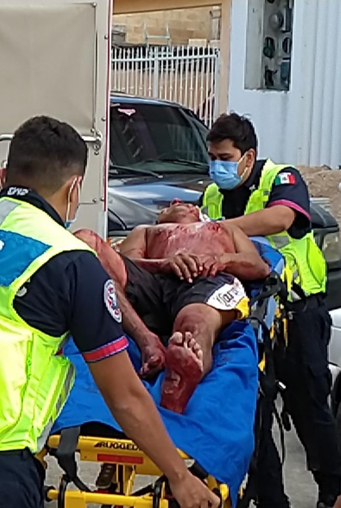 Liman asperezas con machete en Cancún