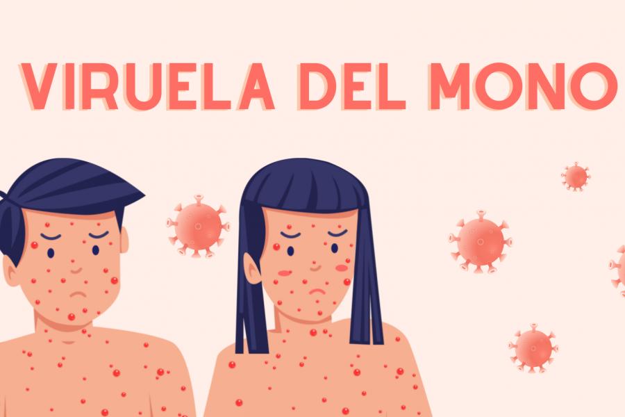 Aprueba OMS primera vacuna contra viruela del mono para niños