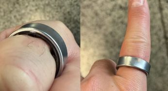 La batería de un anillo inteligente se infló por lo que no podía quitáselo