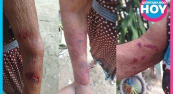 Mujer de la tercera edad denuncia malos tratos y despojo de apoyos sociales por parte de un familiar