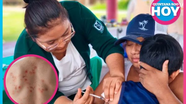 Alerta por sarampión en Quintana Roo: activan filtros escolares