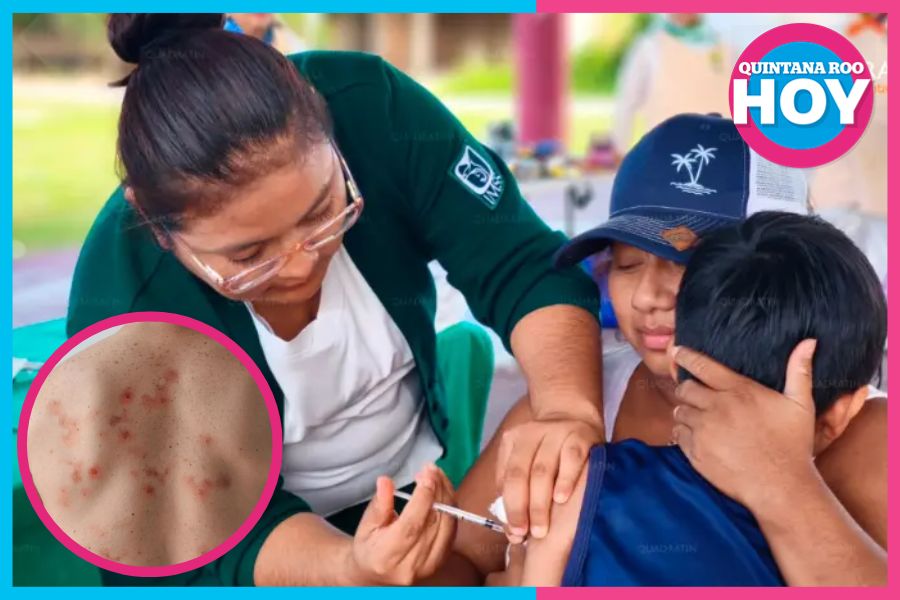 Alerta por sarampión en Quintana Roo: activan filtros escolares