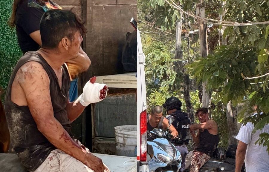 Brutal ataque con machete deja a hombre grave en Tulum