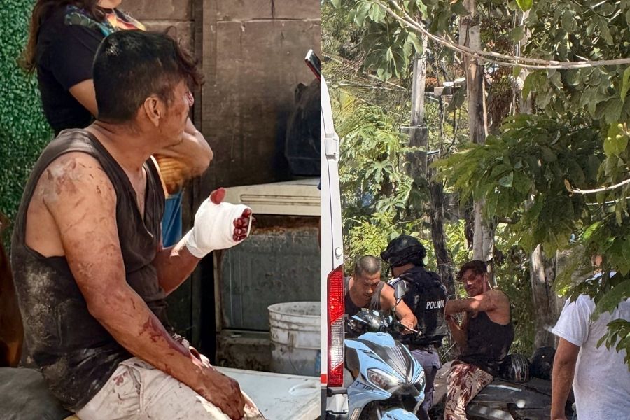 Brutal ataque con machete deja a hombre grave en Tulum