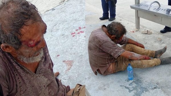 hombre lesionado avenida Kabah Cancún