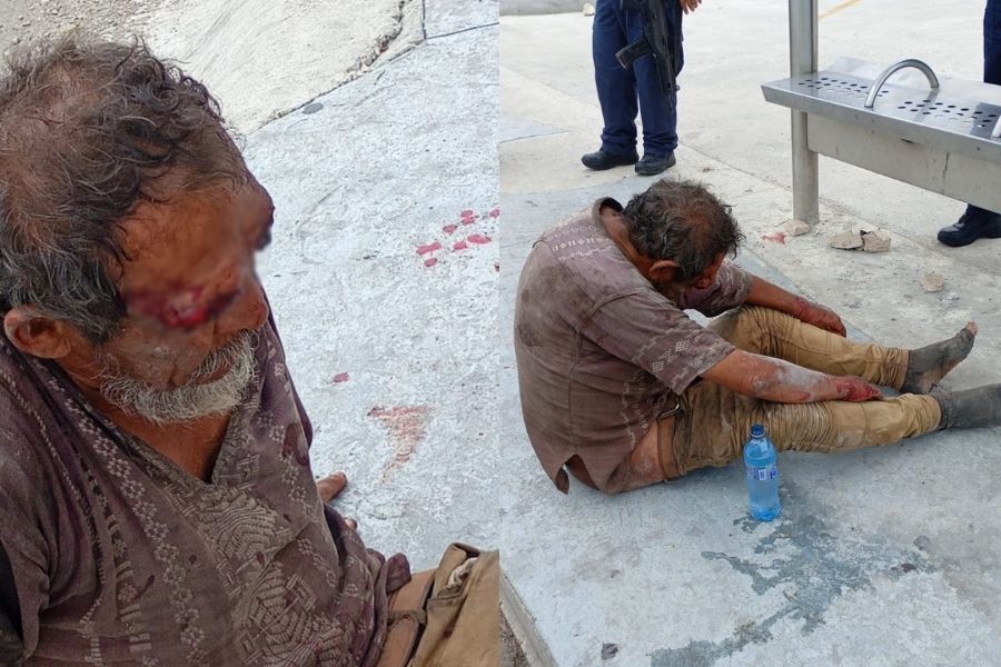 hombre lesionado avenida Kabah Cancún